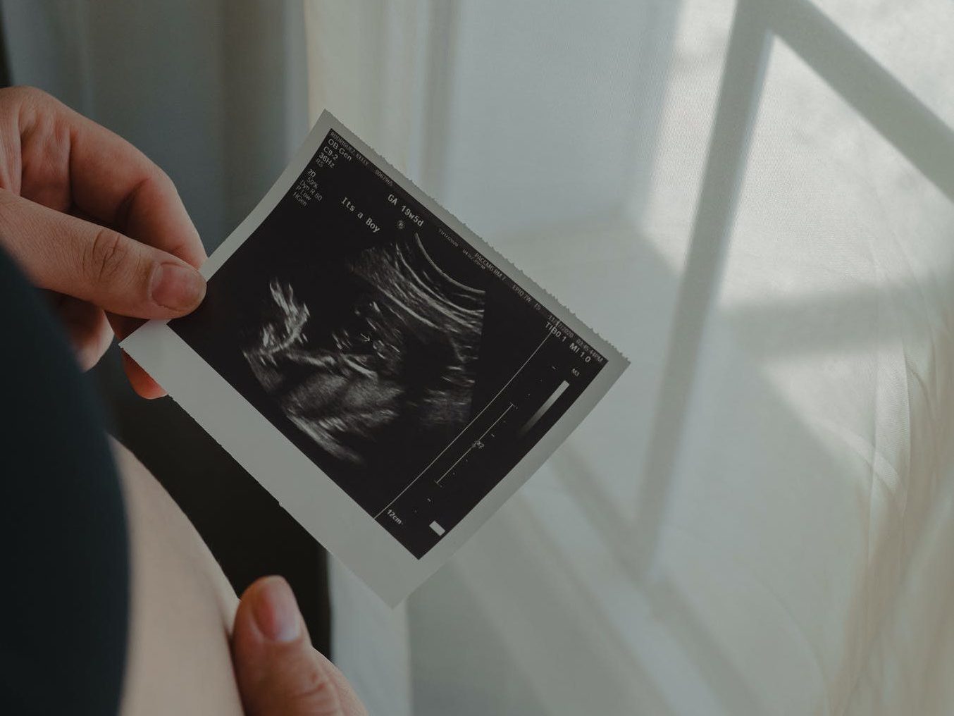 person holding an ultrasound scan photo